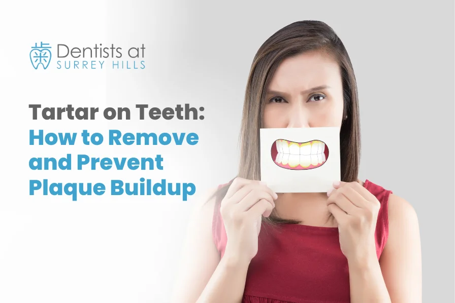 Tartar on Teeth: How to Remove and Prevent Plaque Buildup