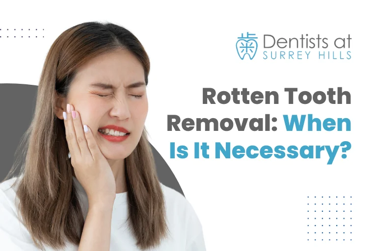 Rotten Tooth Removal When Is It Necessary
