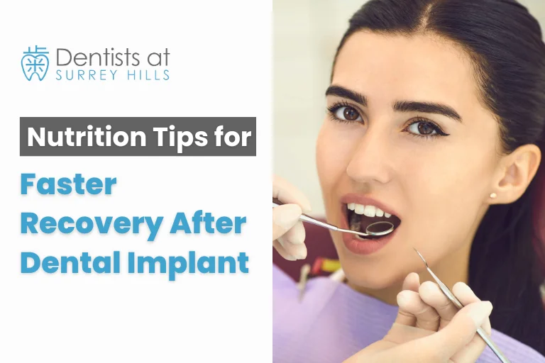 Nutition tips Faster Recovery After Dental ImplantNutition tips Faster Recovery After Dental Implant