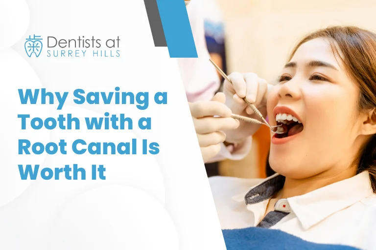 Why Saving a Tooth with a Root Canal Is Worth It